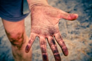 敏感肌のメンズにおすすめの医薬部外品デオドラントは？